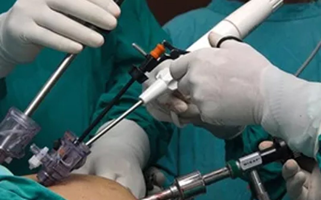 Endoscopia Ginecológica
